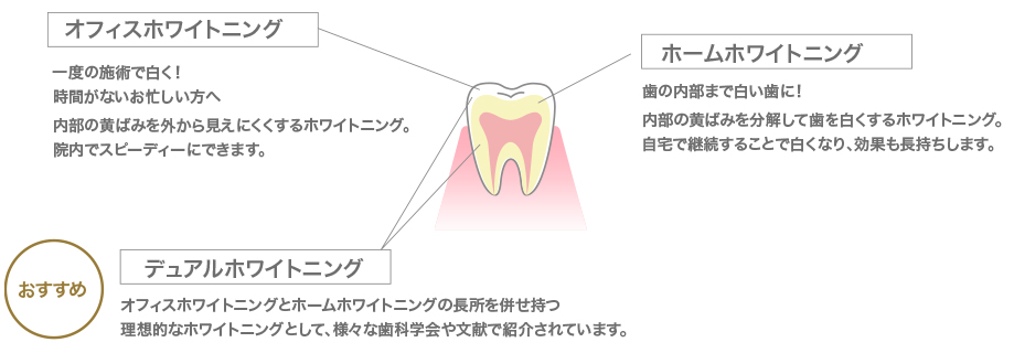 選べる3つのホワイトニングプラン