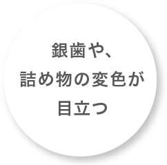 銀歯や、詰め物の変色が目立つ