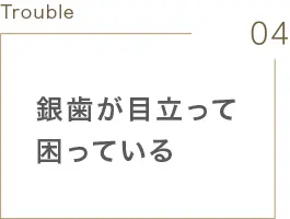 歯の黄ばみ・汚れ・着色が気になる